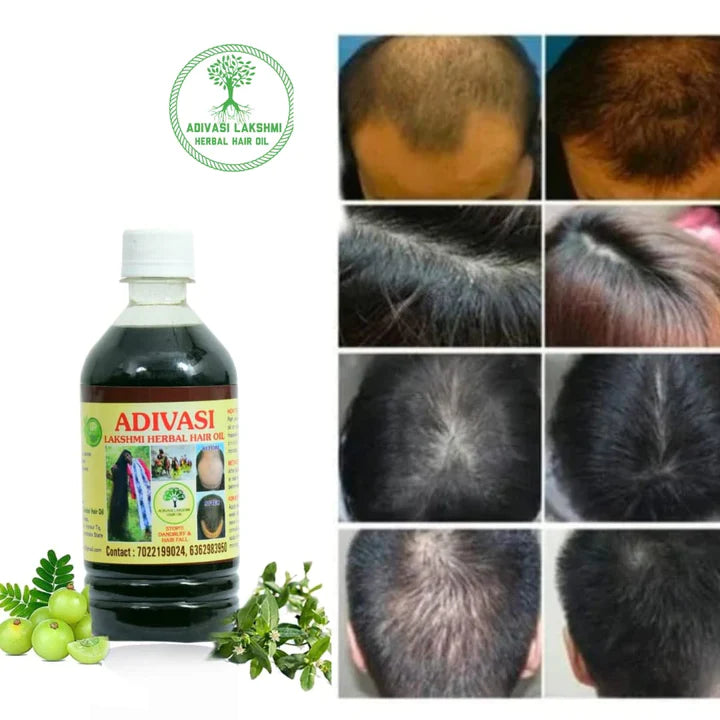 Adivasi Herbal Nilambari Hair Oil (BUY 1 GET 1 FREE)